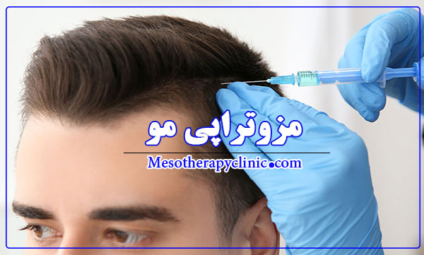 مزوتراپی مو